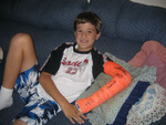 Jonah with his broken arm from falling off his bike